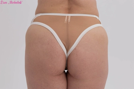 Figi Brazyliany V Antonina