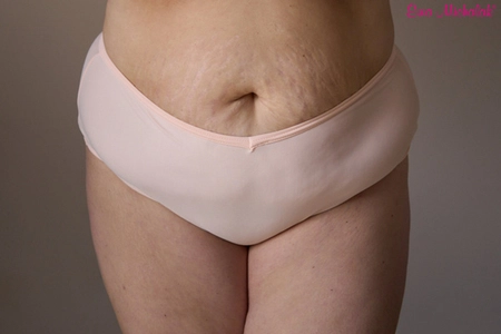 Figi Fupa Magnolia