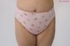 COTTON High Panties Donut