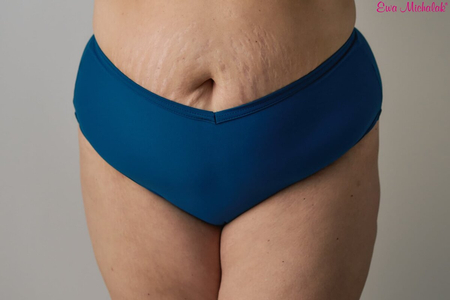 Figi Fupa Diesel
